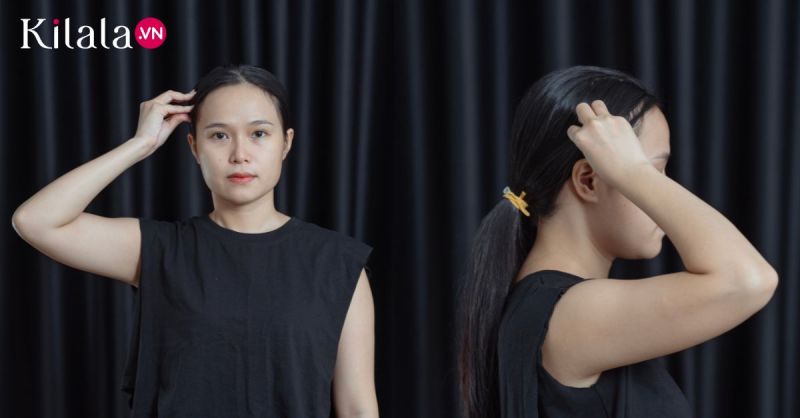 Bước 2: Di chuyển da phía trên cơ thái dương.